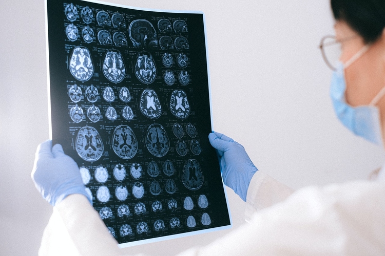 Az idegrendszert érintő krónikus betegségek hatékonyabb kezelését szolgálja három magyar intézmény kutatási programja