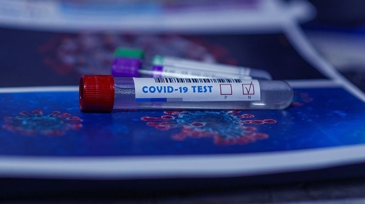 Koronavírus - Több mint 10 ezren vettek részt az országos szűrésen