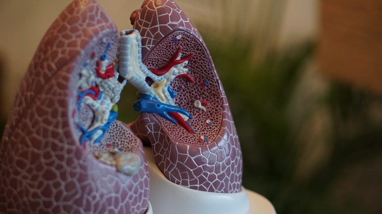 A tüdőrákszűrés fellendítése érdekében indul program az ország több pontján